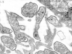 Mumps (microscope)